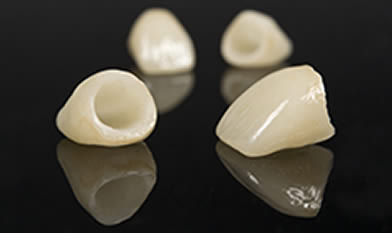 Dr. Carlos Garcia, Bright Smiles Dental Studio Image Of Crowns