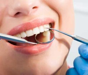 Dental implant options for patients in La Crescenta